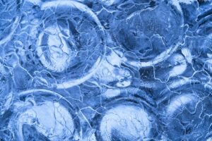 埋没法による眼瞼下垂の悪化を防ぐための注意点は？